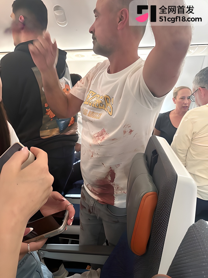 迪拜航空遇袭事件 5