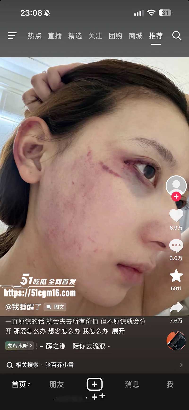 千万大V张百乔家暴视频被扒 27 拷贝