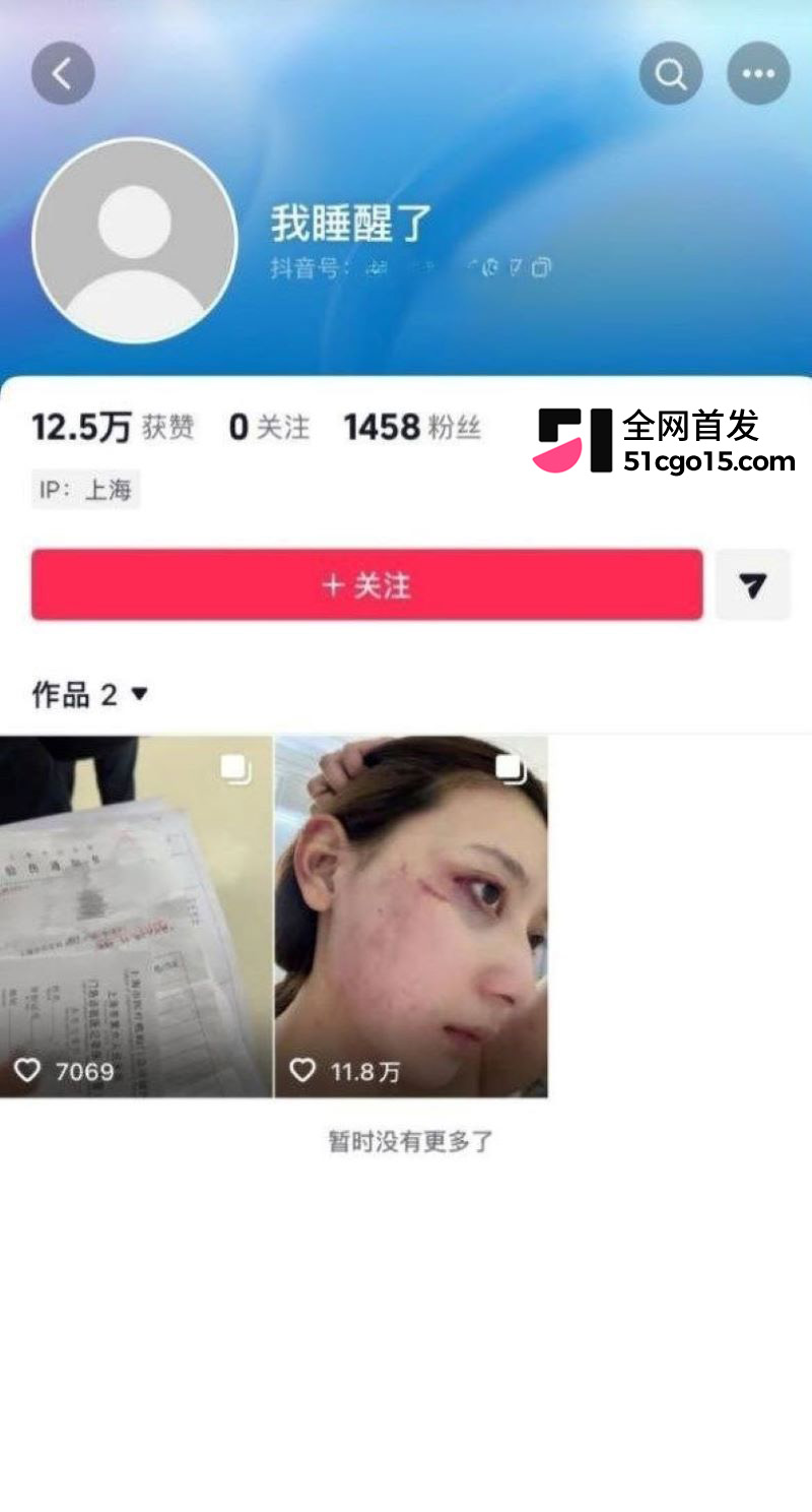 顶流网红张百乔小雪陷婚变 2