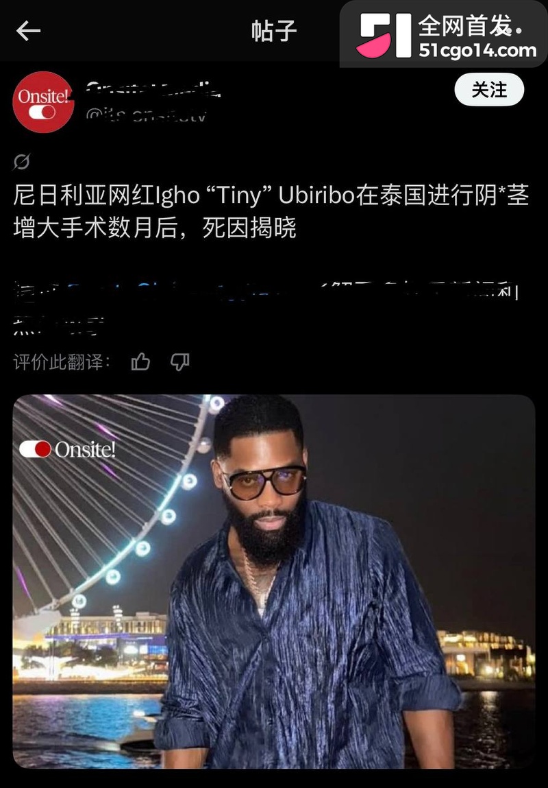 英籍网红 Tiny 18