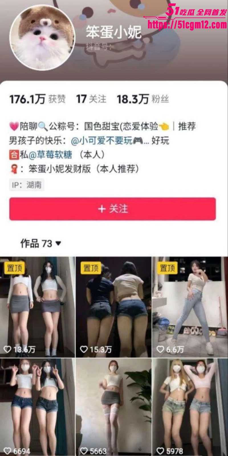 抖音网红 笨蛋小妮 定制福利合集  1