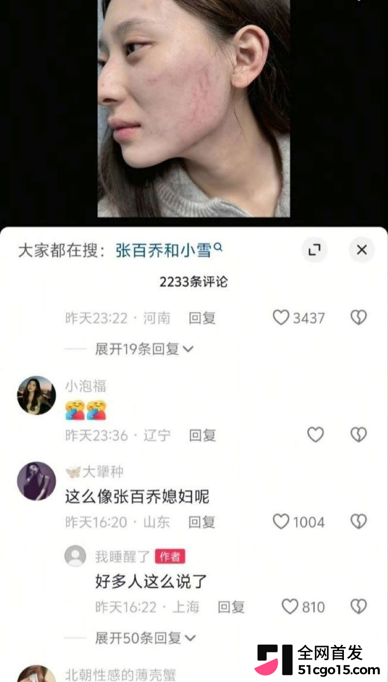 顶流网红张百乔小雪陷婚变 14