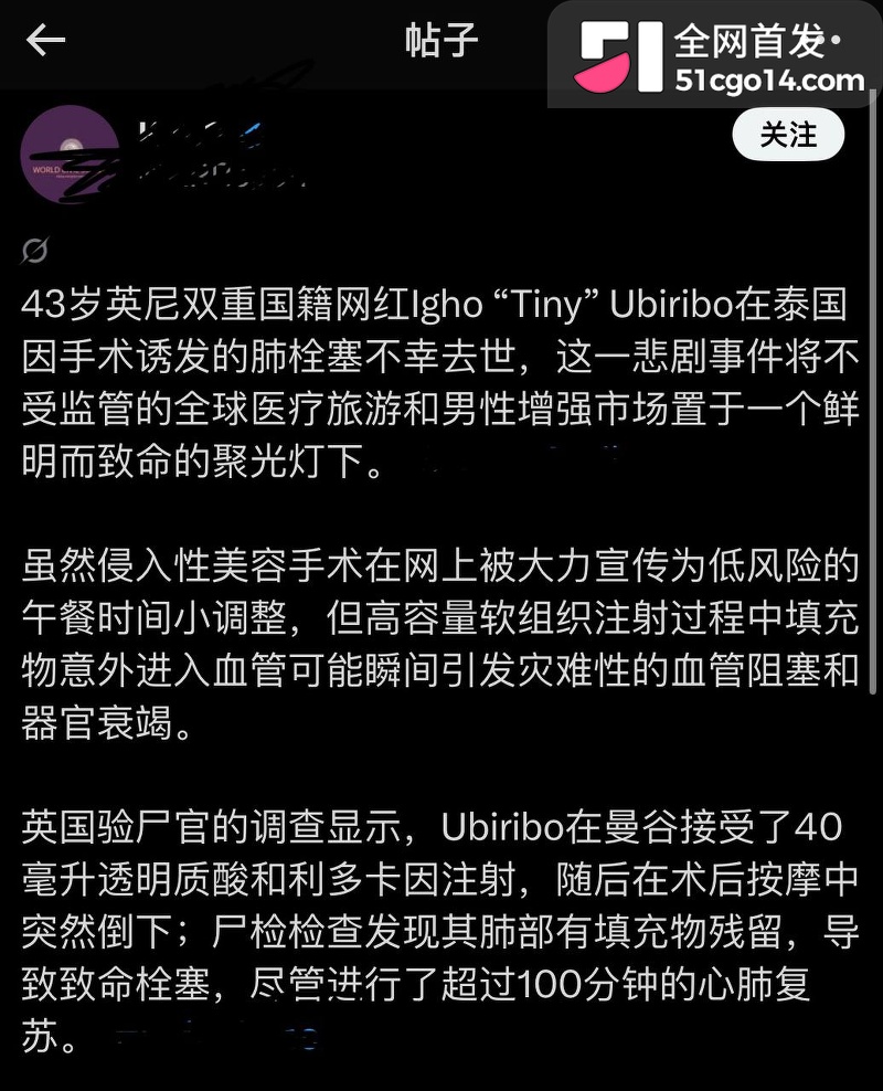 英籍网红 Tiny 13