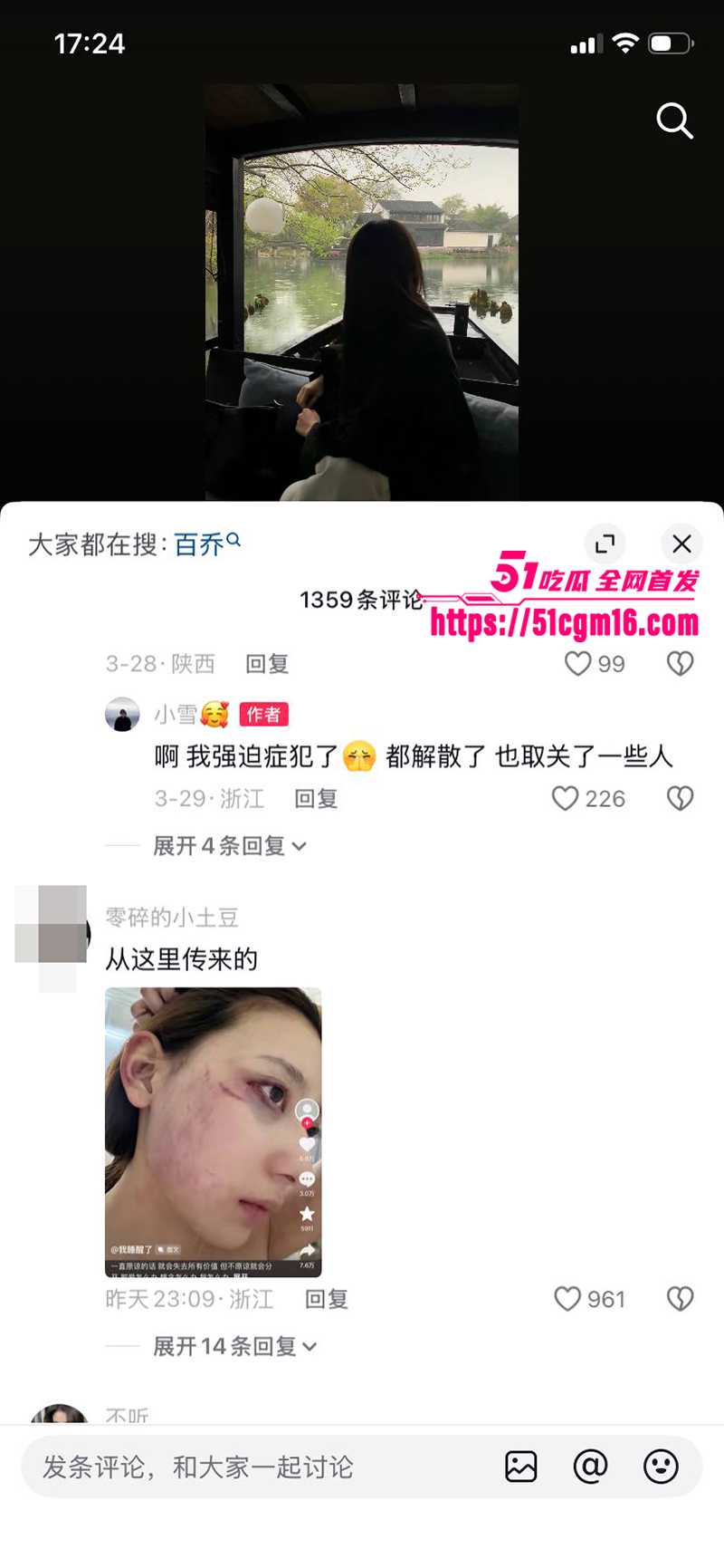 千万大V张百乔家暴视频被扒 18 拷贝
