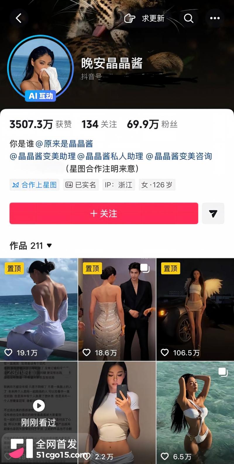老戴砸钱整容养出百万网红2